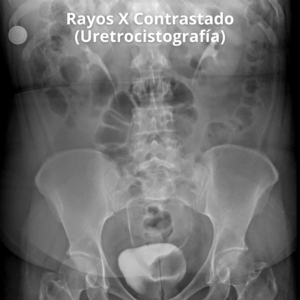 Rayos X Contrastado Uretrocistografia