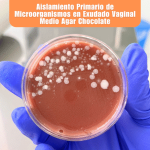 Laboratorio de Microbiología 1 Laboratorio de Microbiologia Aislamiento Primario de Microorganismos en Exudado Vaginal Medio Agar Chocolate