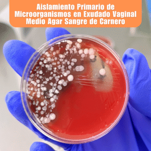 Laboratorio de Microbiología 2 Laboratorio de Microbiologia Aislamiento Primario de Microorganismos en Exudado Vaginal Medio Agar Sangre de Carnero
