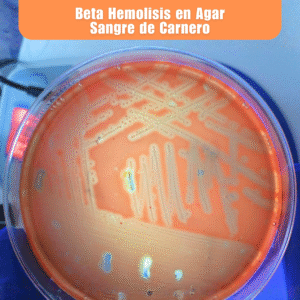 Laboratorio de Microbiología 10 Laboratorio de Microbiologia Beta Hemolisis en Agar Sangre de Carnero