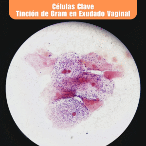 Laboratorio de Microbiología 6 Laboratorio de Microbiologia Celulas Clave Tincion de Gram en Exudado Vaginal