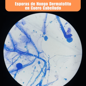 Laboratorio de Microbiología 12 Laboratorio de Microbiologia Esporas de Hongo Dermatofito en Cuero Cabelludo