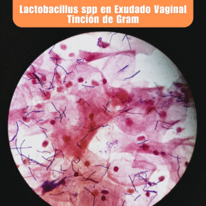 Laboratorio de Microbiología 7 Laboratorio de Microbiologia Lactobacillus spp en Exudado Vaginal Tincion de Gram