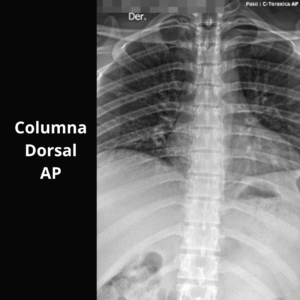 Rayos X Columna Dorsal AP