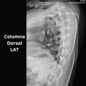 Rayos X Columna Dorsal LAT