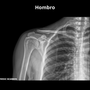 Rayos X Hombro