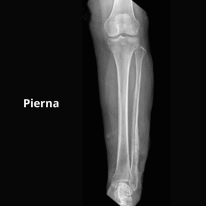 Rayos X Pierna