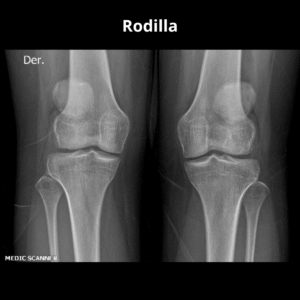 Rayos X Rodilla