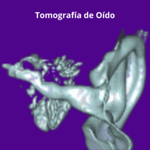 Tomografia de Oido