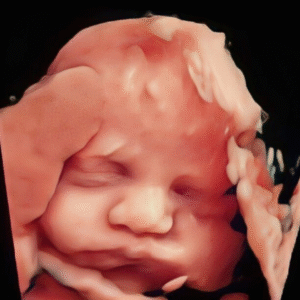 Ultrasonido 4D HD Live 11