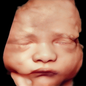 Ultrasonido 4D HD Live 2