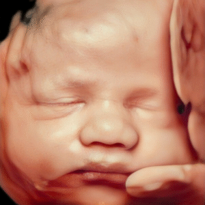 Ultrasonido 4D HD Live 3