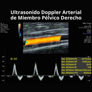 Ultrasonido Doppler Arterial de Miembro Pelvico Derecho 1