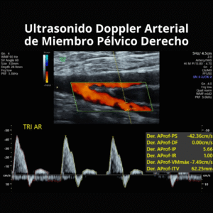 Ultrasonido Doppler Arterial de Miembro Pelvico Derecho 2