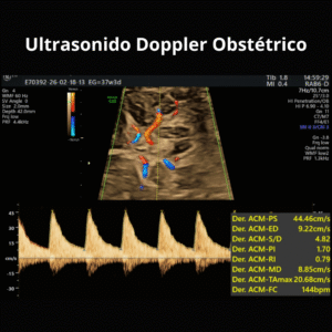 Ultrasonido Doppler Obstetrico 1