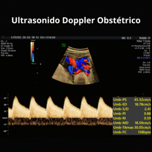 Ultrasonido Doppler Obstetrico 2