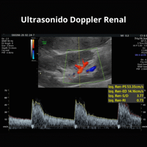 Ultrasonido Doppler Renal 1