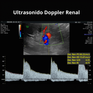 Ultrasonido Doppler Renal 2