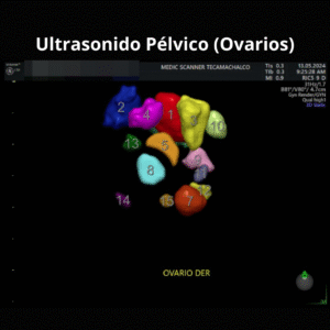 Ultrasonido Pelvico Ovarios 1