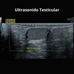 Ultrasonido Testicular 1