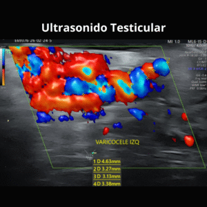 Ultrasonido Testicular 2
