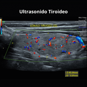 Ultrasonido Tiroideo 2