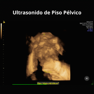 Ultrasonido de Piso Pelvico 2